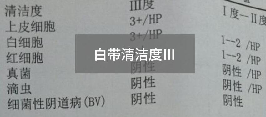 今天快讯！全自动白带91香蕉视频色生产厂家香蕉视频免费APP为您官方解释白带清洁度3的意思