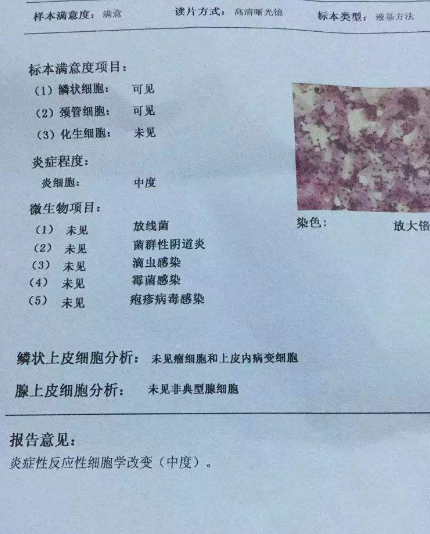 阴道分泌物香蕉视频下载地址厂家教你查看阴道分泌物检测报告