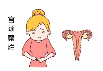 宫颈糜烂会导致宫颈癌?白带91香蕉视频色品牌：不要自己吓自己