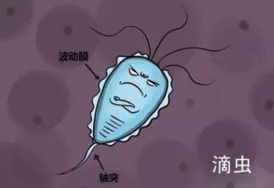 白带香蕉视频下载地址品牌介绍滴虫性阴道炎的早期症状以及预防方法