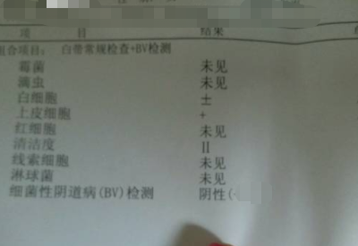 全自动白带91香蕉视频色分享如何看懂白带常规检测报告单